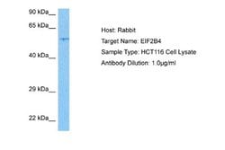 eIF2B4 Antibody, Novus Biologicals 100 &mu;L | Buy Online | Novus Biologicals | Fisher Scientific